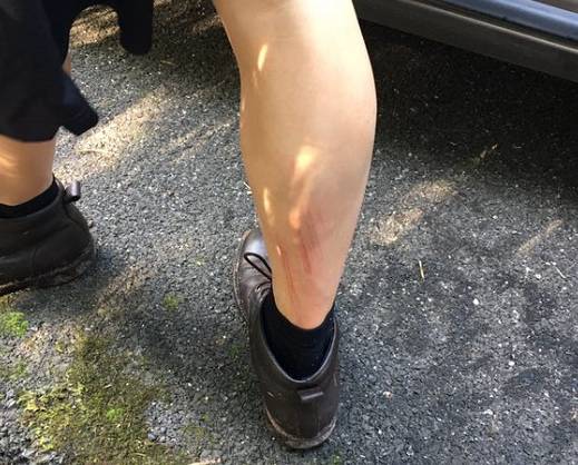 突发！小车被撞入湖中迅速下沉 1车4人还有孕妇