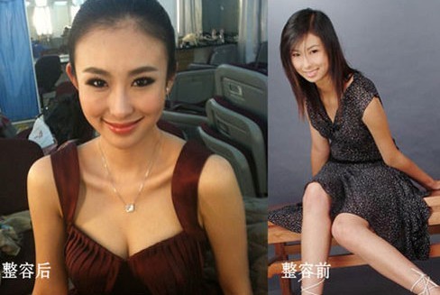 高清:明星整容资料外泄 郭晶晶金妍儿乳神潘晓