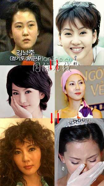 <em>天下</em>无<em>丑女</em>!+韩国整容术太惊人