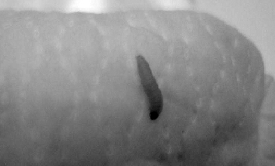 怎么看小孩有没有虫子 2075313801256847762.jpg