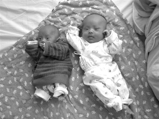 并明确是单<em>卵</em>还是双<em>卵双胎</em>