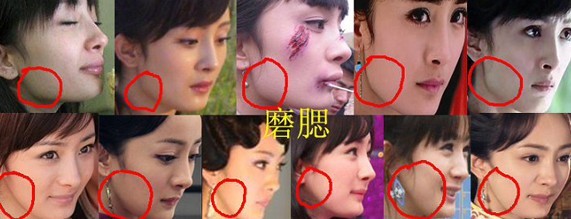 揭秘杨幂李小璐李民浩林心如整容