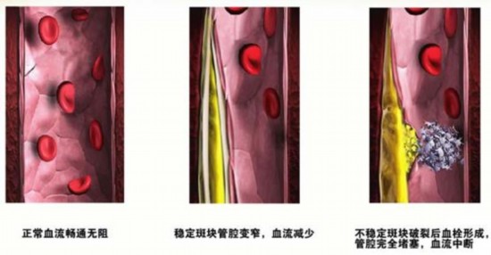 血管是否被堵塞,摸摸足背就能知道