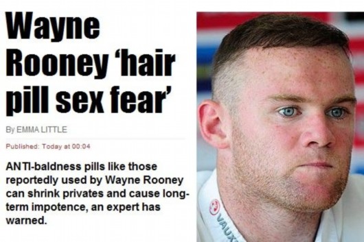 鲁尼为治愈秃顶不惜冒阳痿风险 专家:尺寸或缩小