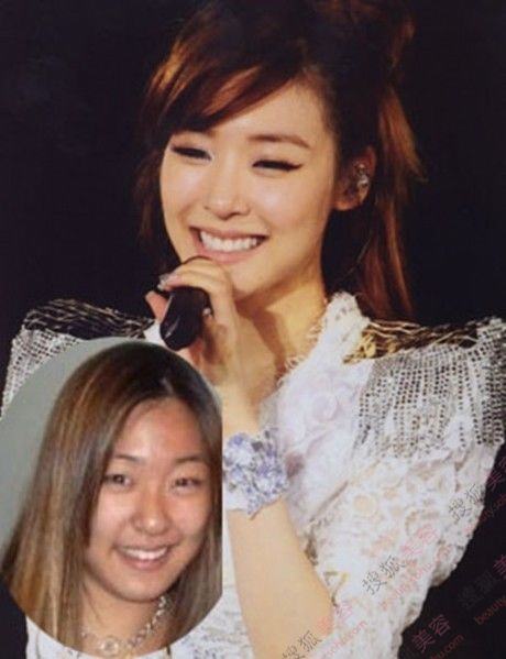 图揭<em>少女</em>时代<em>整容前后</em>对比照 允儿金泰妍路人