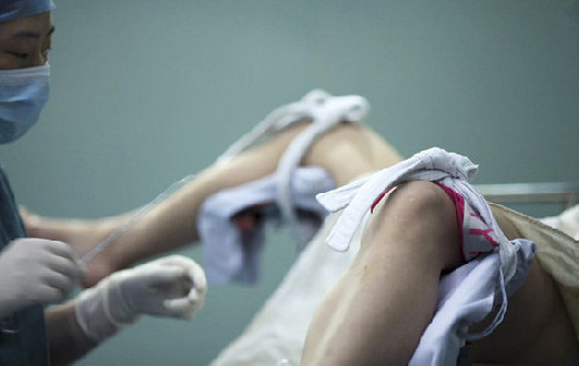 <em>女孩</em>做<em>人流</em>叫来5男友+实拍<em>少女</em>做<em>人流</em>全程/组