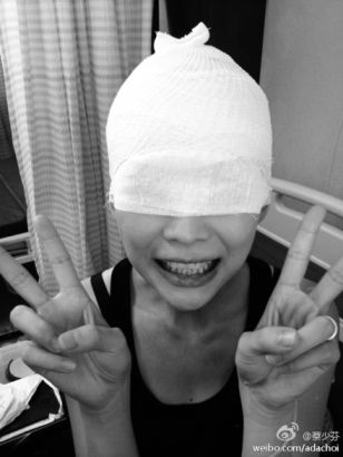 蔡少芬头缠纱布变蒙眼超人 嘟嘴吐舌吓网友(图)