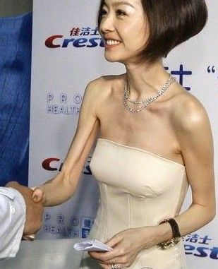 怎么才能瘦得皮包骨头 1683003283780881736.jpg