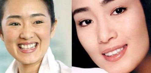 龅牙<em>妹</em>也有春天 杨颖高圆圆整牙后瞬变女神_娱