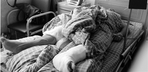 血友病男子为治好残疾多年的腿 冒风险上了手