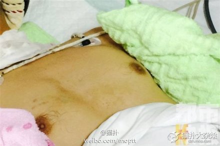 男<em>教师</em>偷拍女生<em>洗澡</em>被打重伤 事前骗家人说出