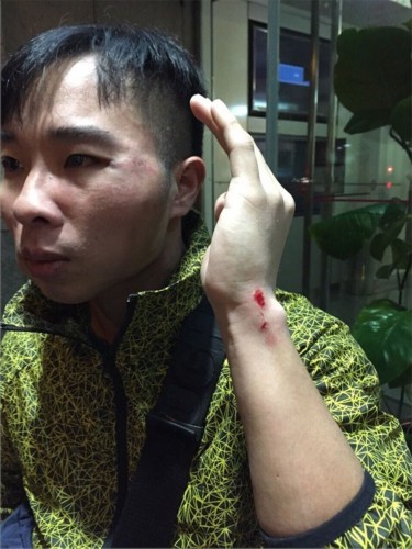 香港警察被当街殴打受伤 嫌犯称我是占中的