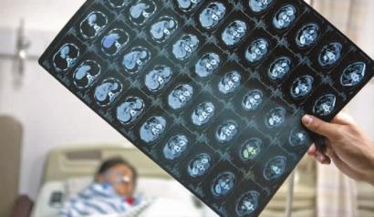 吉林农妇胆道取出18条蛔虫 称爱生吃黄瓜青菜