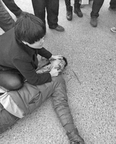 护士路遇车祸跪地救人致膝盖淤青(图)