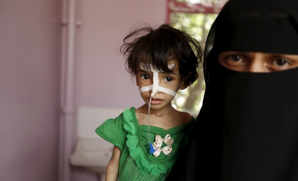 也门内战中营养不良的儿童(高清组图)_新闻中心_中国网