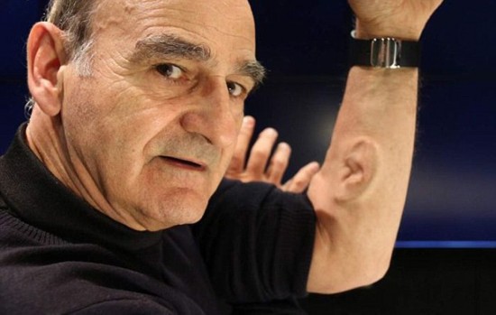 澳行为艺术家手臂上移植耳朵 计划装蓝牙耳机