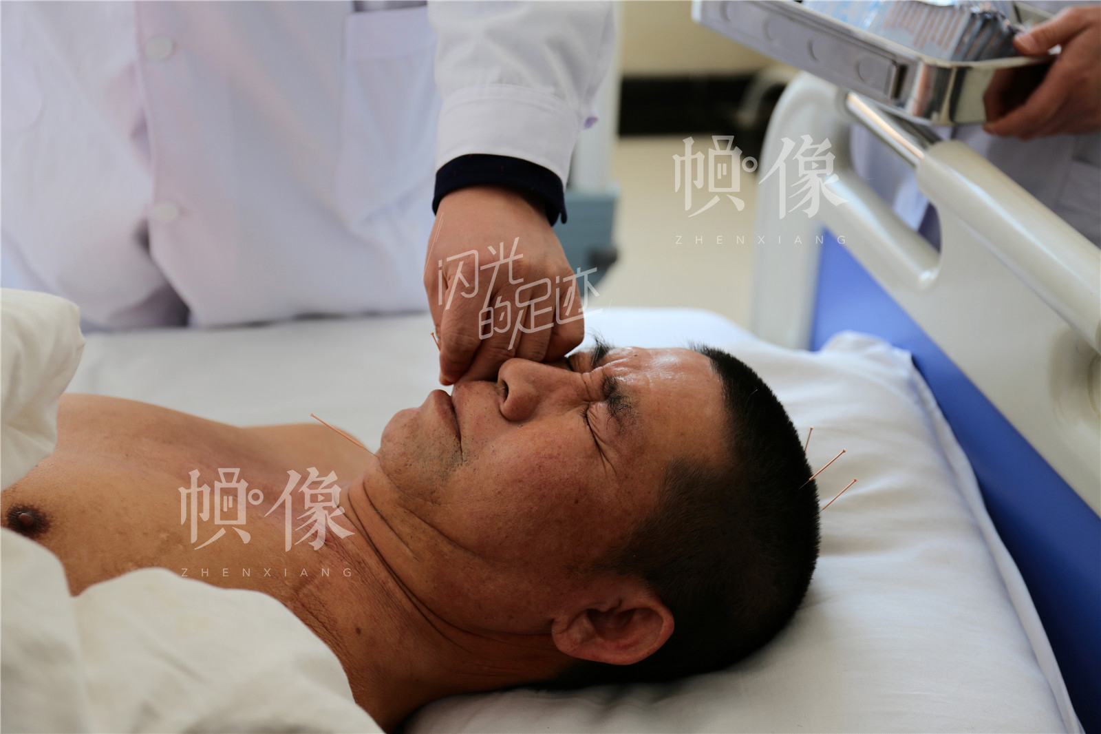 “医养结合”是张坊镇金海养老中心的特色内容，王金海每天上午例行查房后都会为患者做针灸治疗。中国网记者 黄富友 摄