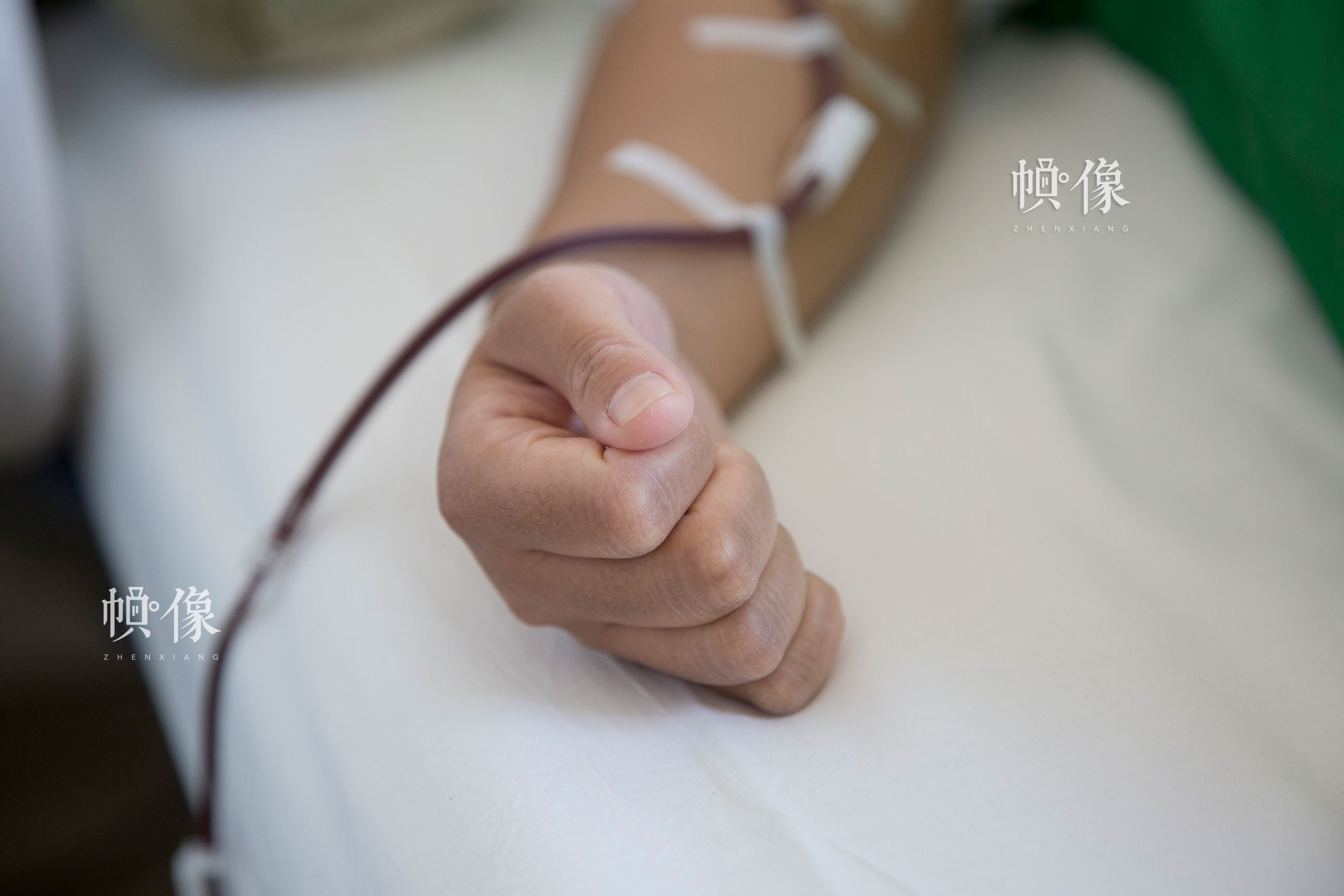 2017年8月30日，北京海军总医院，配型成功的曲女士进行造血干细胞捐献，为了保持血液流动更为顺畅，全程手都要保持做“张开-握拳”的运动。中国网记者 赵超 摄