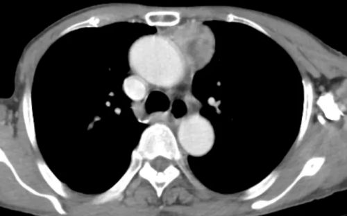 8B%I~PVDW0(84OEDS$JZ}IN.png 8B%I~PVDW0(84OEDS$JZ}IN.png