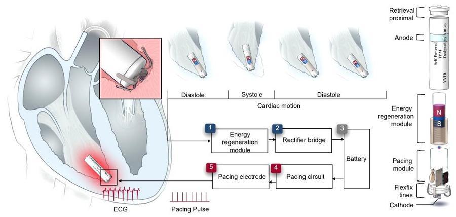 我国科学家研制出&ldquo;胶囊版&rdquo;自供电微型心脏起搏器