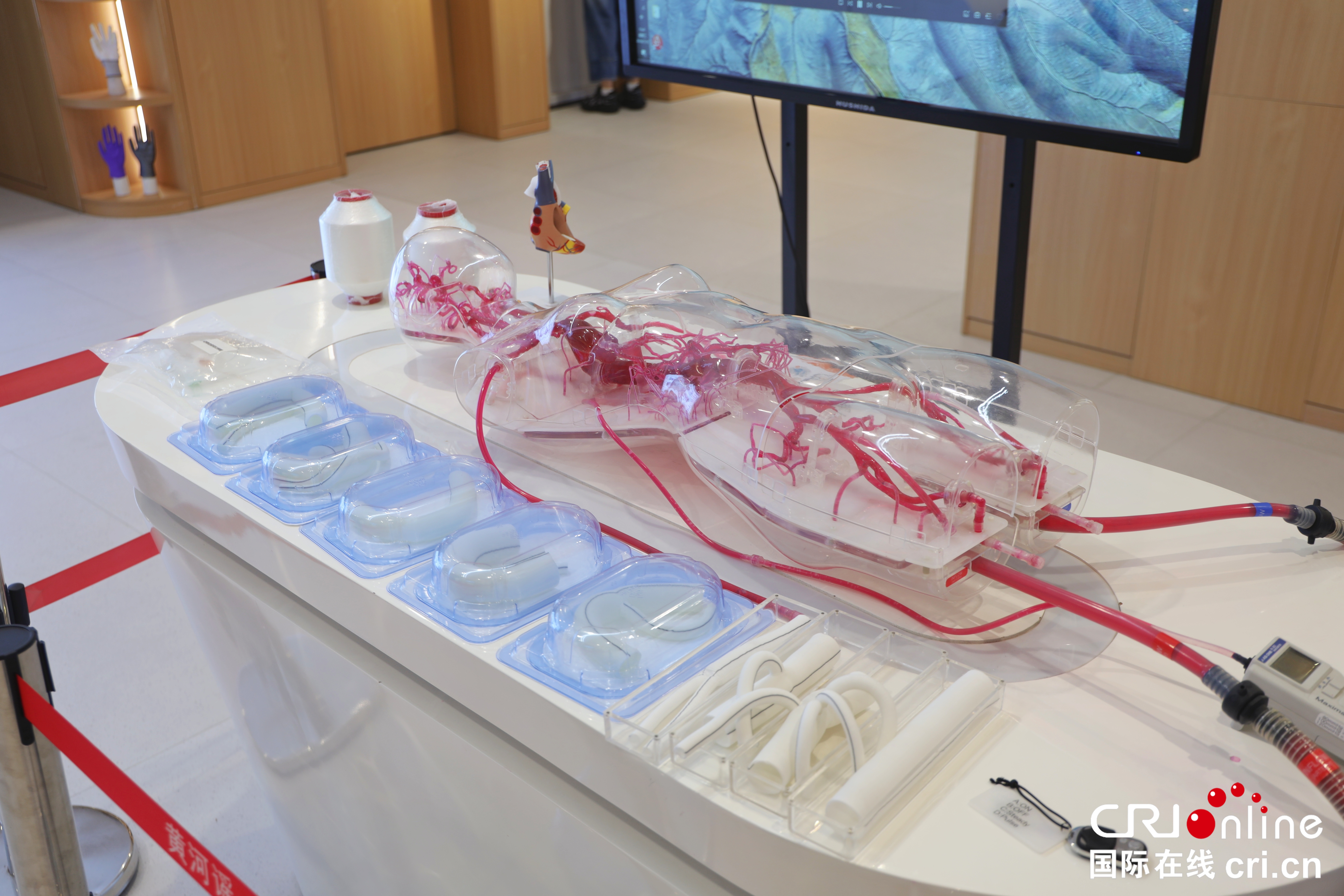 北京宣武医院陈飞医生黄牛预约代挂号电话从“一根细纱”到“人造血管”,纺织产业跨界向新