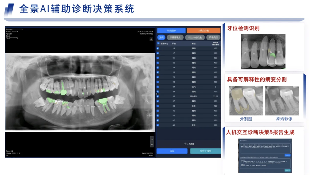 从辅助诊断到“人机共智”AI医疗如何健康规范发展(图2) 从辅助诊断到“人机共智”AI医疗如何健康规范发展(图2)