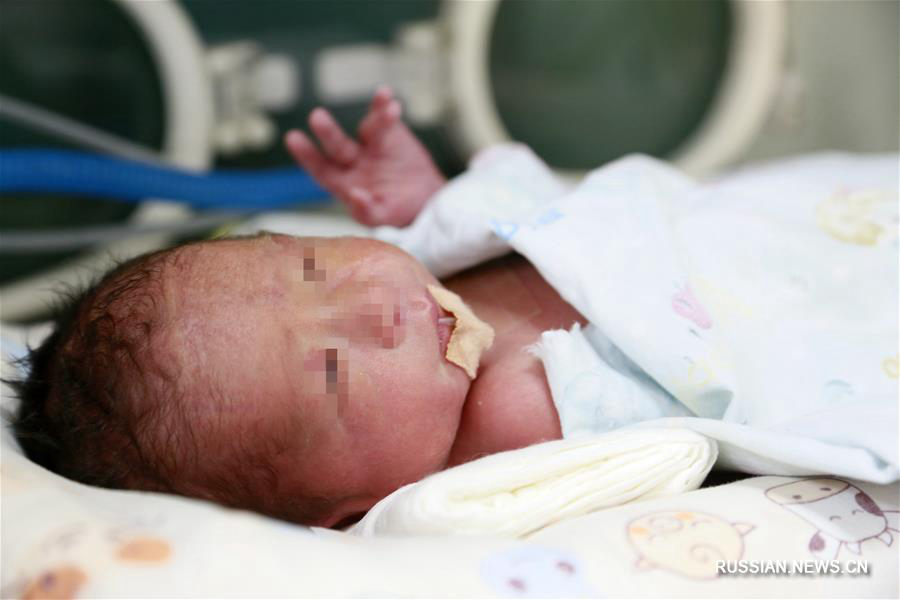 В Сиане родился первый в Китае младенец, зачатый и выношенный в пересаженной матке