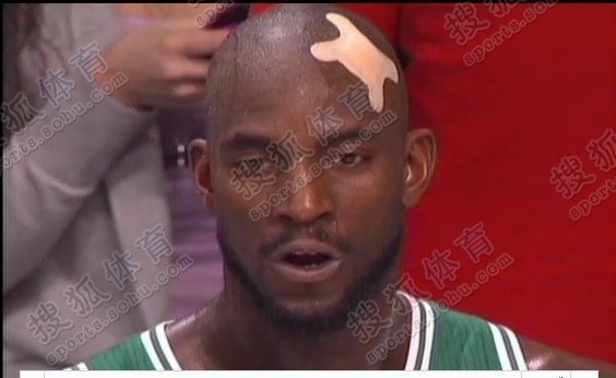Kevin Garnett, de Lakers, está herido en la cabeza